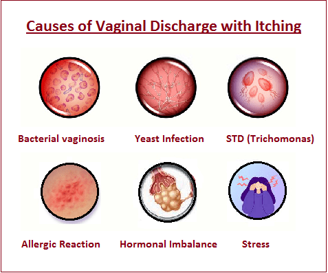 https://ariesonlineclinic.com/wp-content/uploads/2023/10/causes-of-vaginal-discharge-with-itching.png